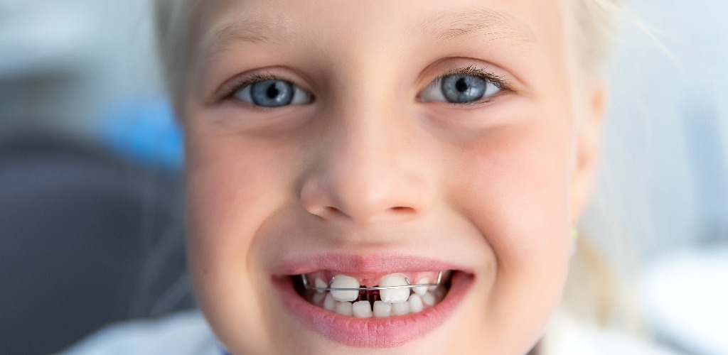 Little blond happy kid girl at dentist office smiling showing diastema overbite teeth missing gap child during orthodontist visit and oral cavity check up children tooth care and hygiene jpg