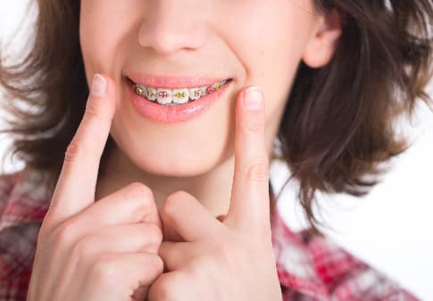 Beautiful girl with perfect skin and multi-colored braces posing on white backgraund